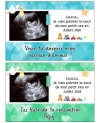 Carte annonce de grossesse avec votre échographie personnalisable