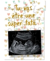 Puzzle grossesse. puzzle echographie. demande marraine.